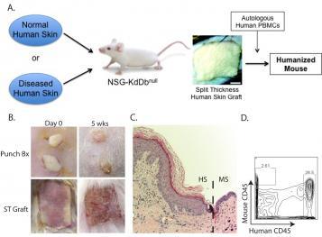 Research (Rosenblum) | UCSF School of Medicine Department of Dermatology